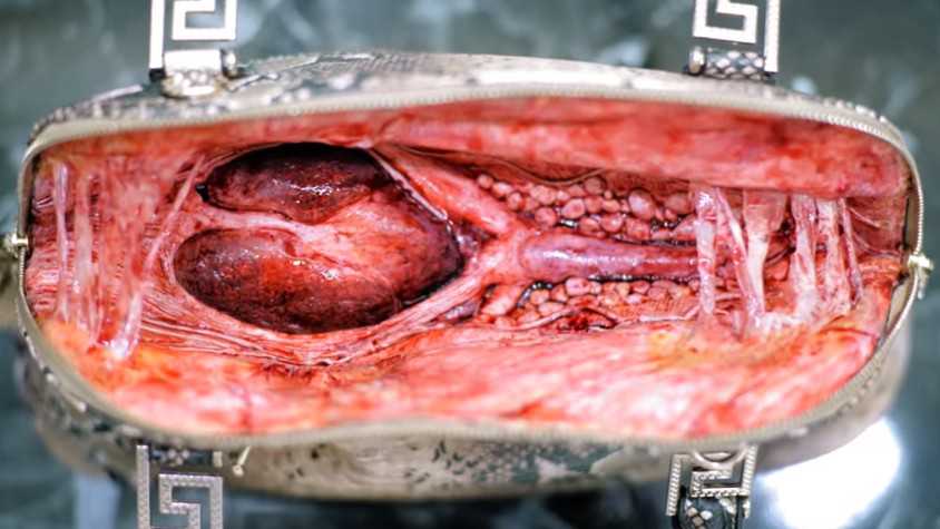 #BEHINDTHELEATHER: ONG PETA mostra o que tem por trás do couro de peças de luxo